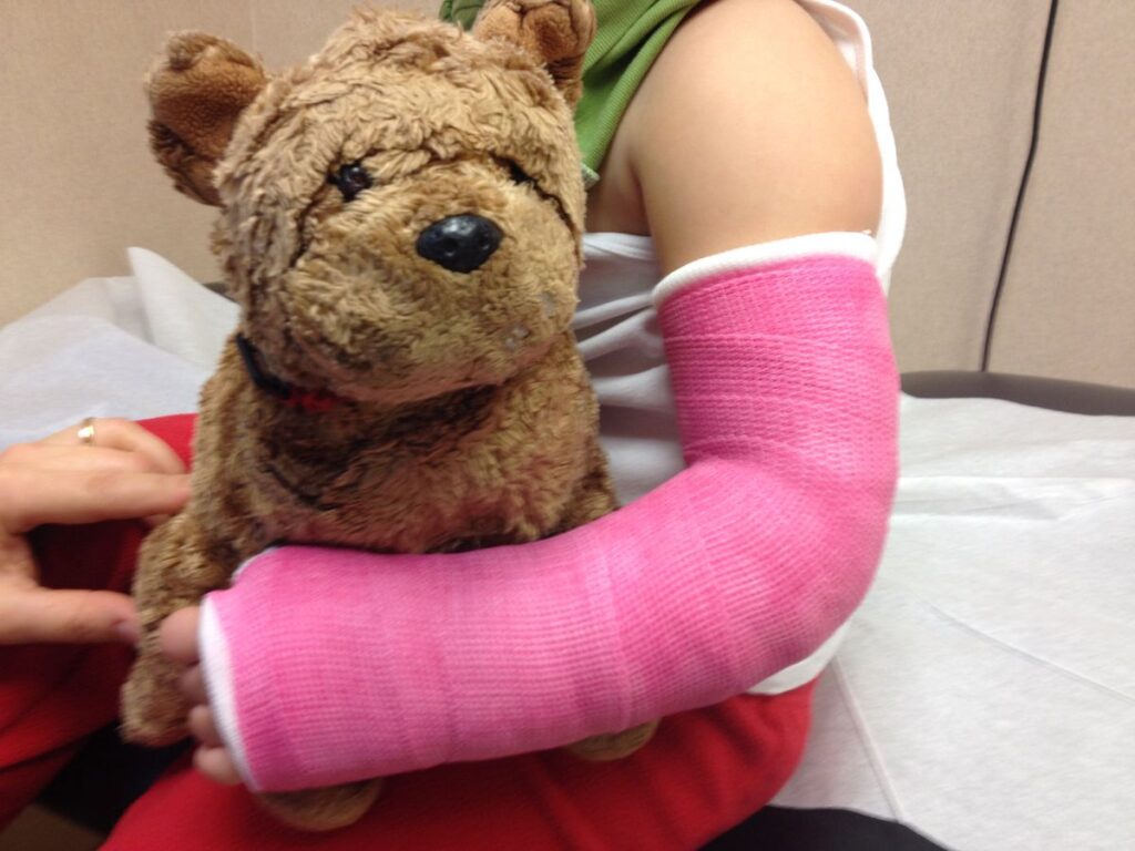 Child with arm cast recovering from pediatric fracture treatment